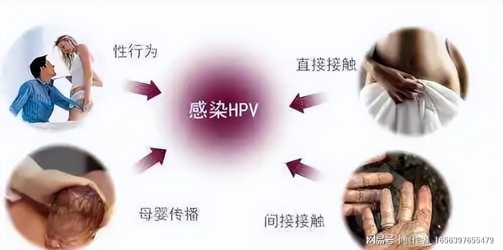 感染HPV？男子在上海治病的惊险历程，10天花光积蓄，真相究竟如何？